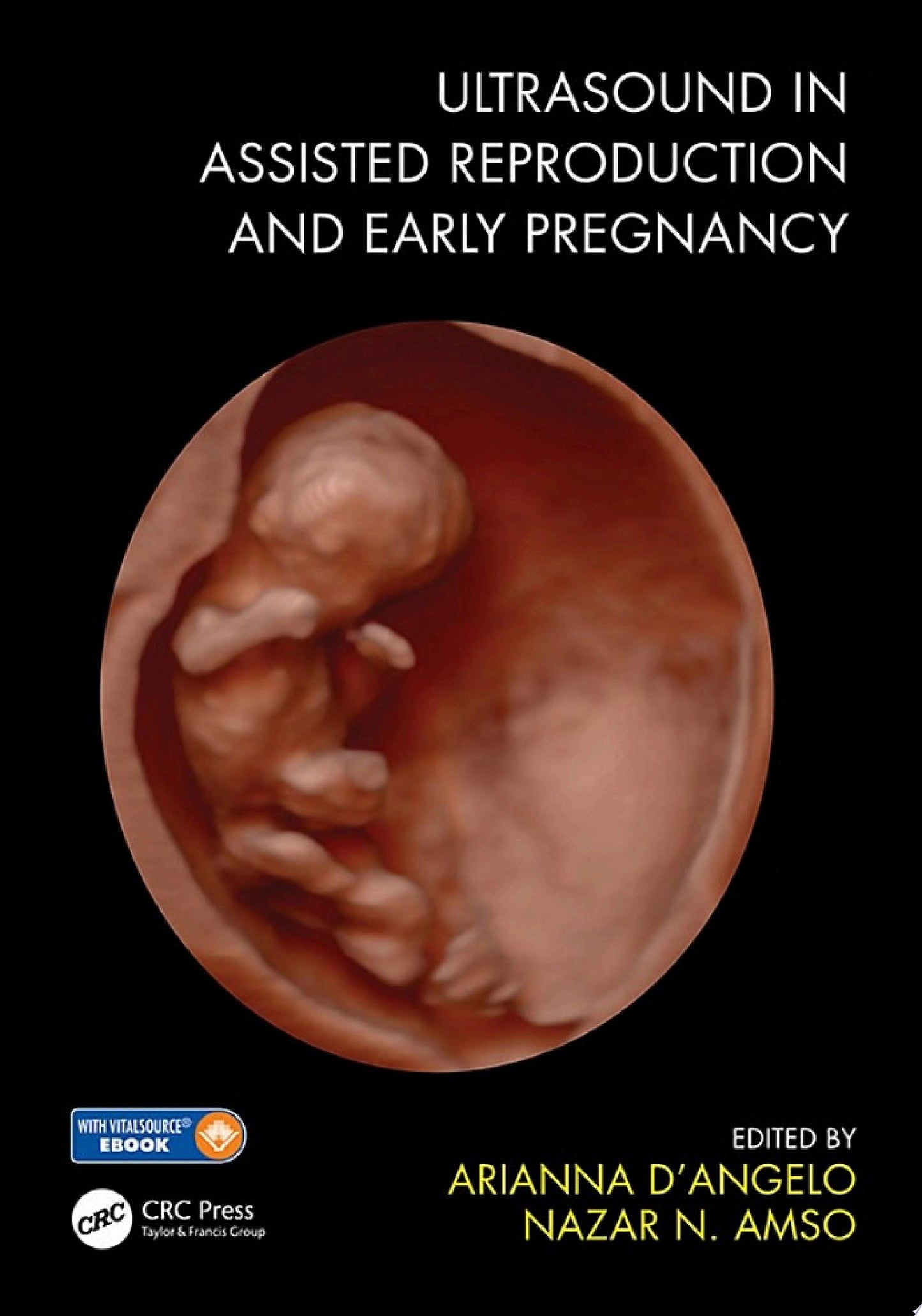 Ultrasound in Assisted Reproduction and Early Pregnancy