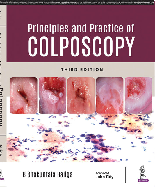 Colposcopy in Practical Gynecology, 3rd Edition