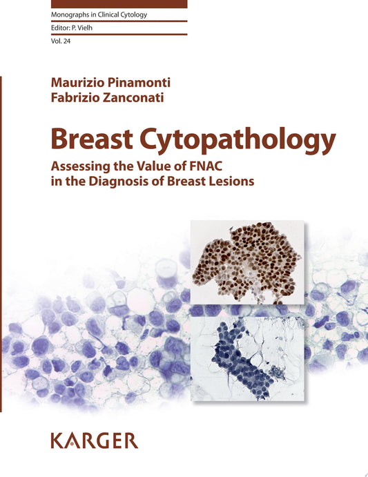 Breast Cytopathology: Assessing the Value of FNAC in the Diagnosis of Breast Lesions