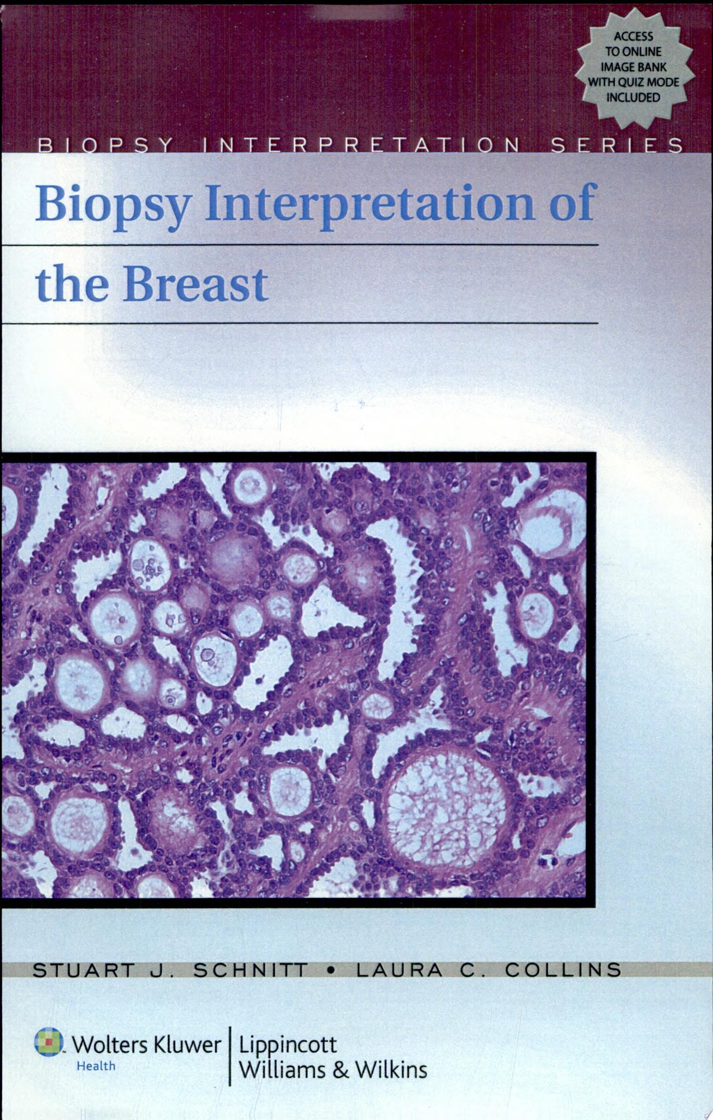 Biopsy Interpretation of the Breast, 2nd Edition