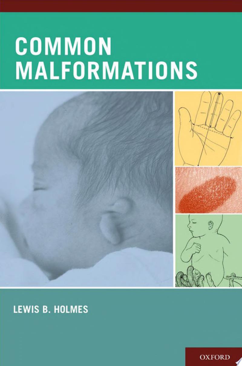 Common Malformations