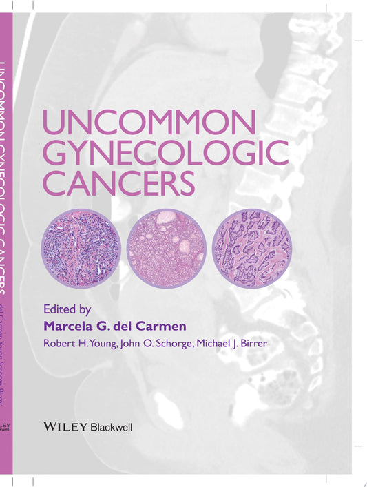 Uncommon Gynecologic Cancers