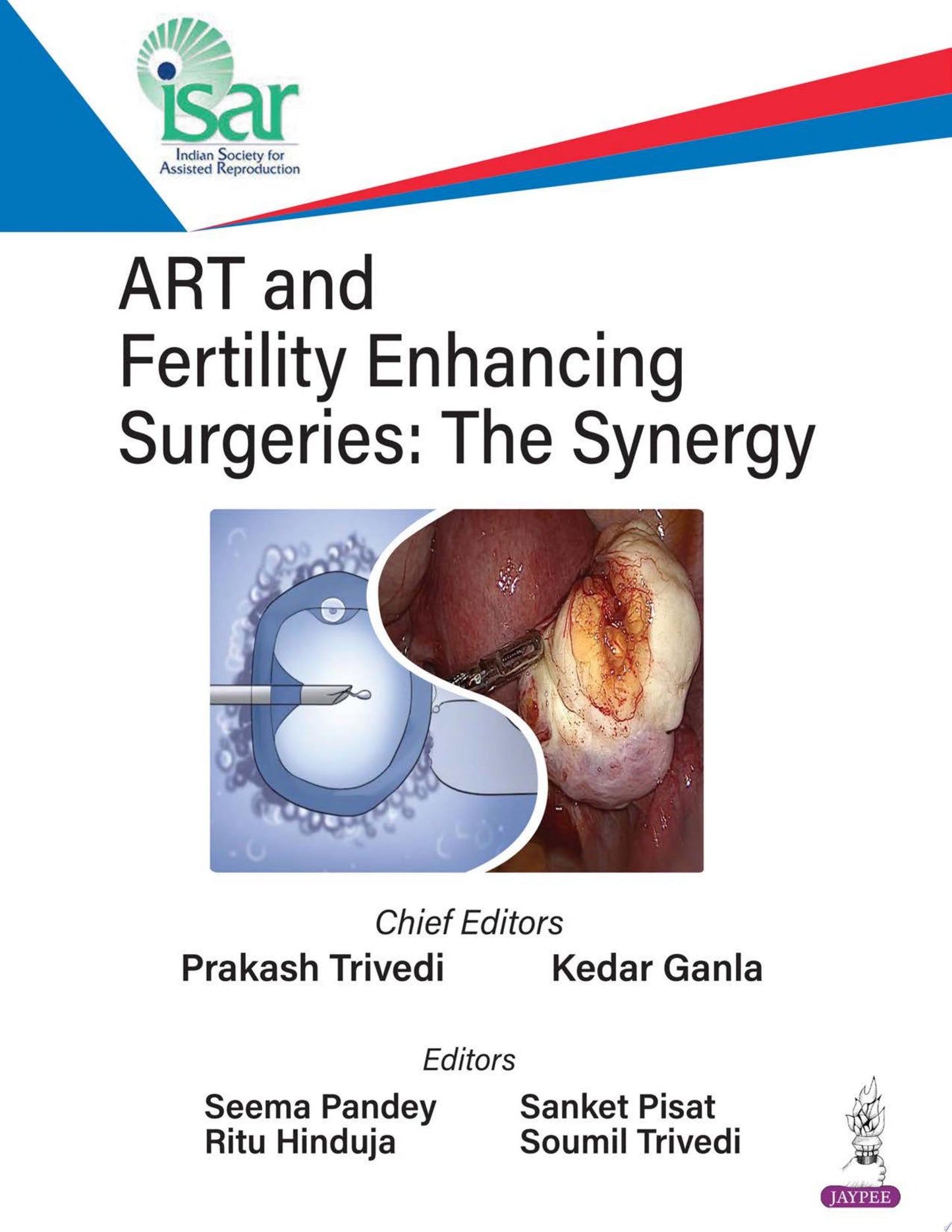 ART and Fertility Enhancing Surgeries: The Synergy
