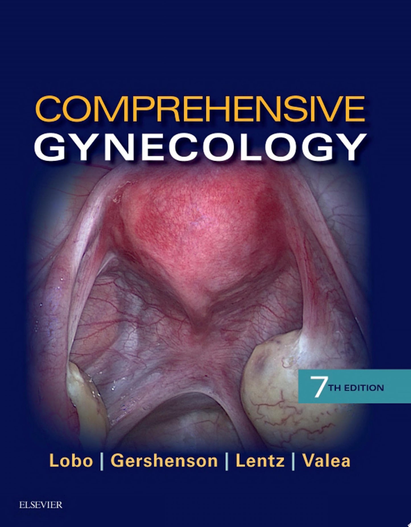 Comprehensive Gynecology, 7th Edition