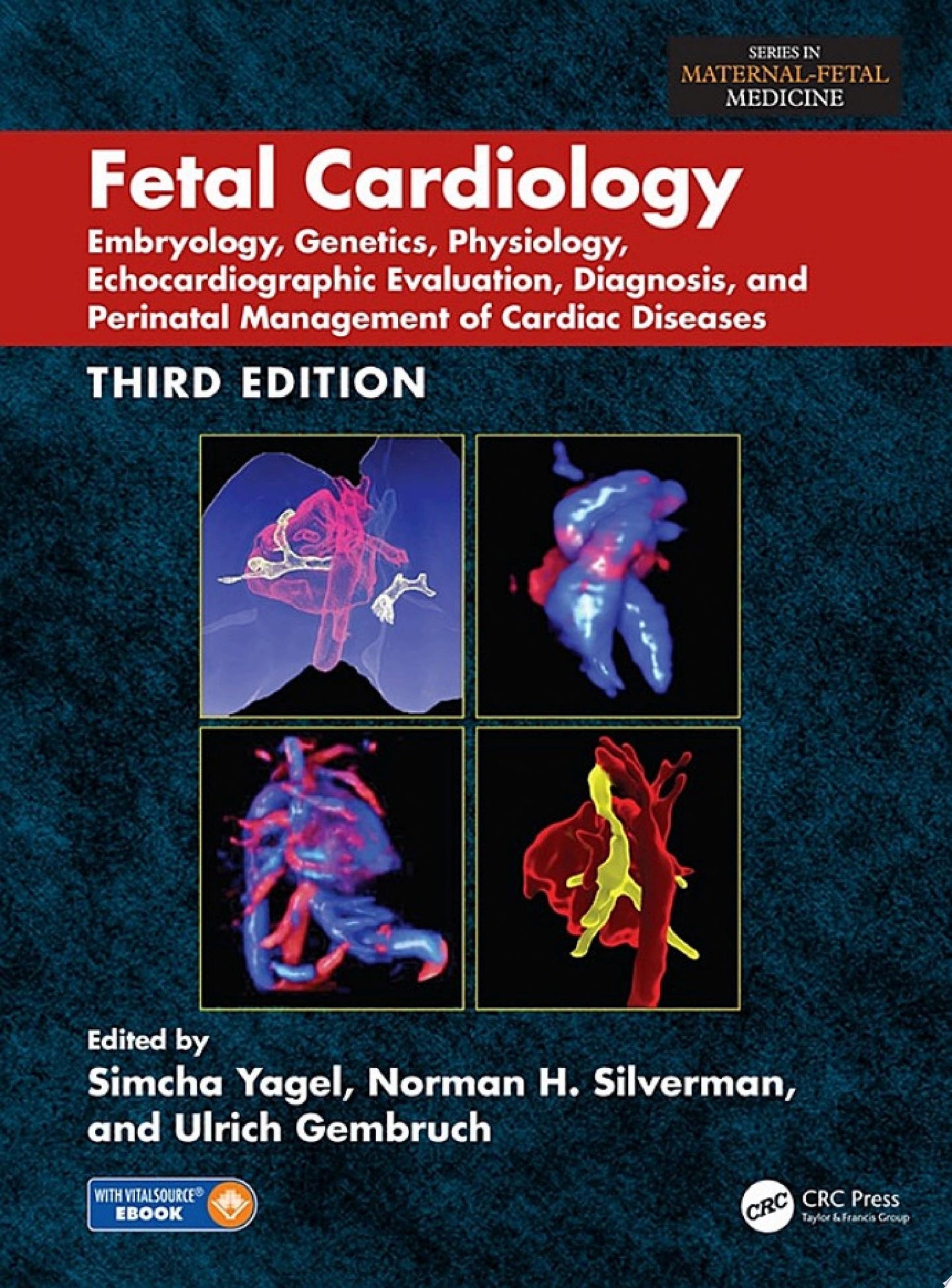 Fetal Cardiology, 2nd Edition
