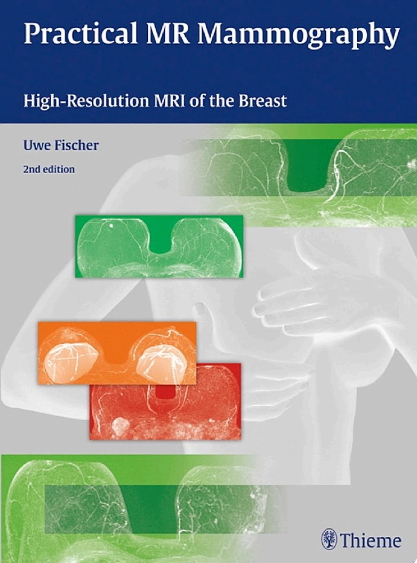 Practical MR Mammography: High-Resolution MRI of the Breast