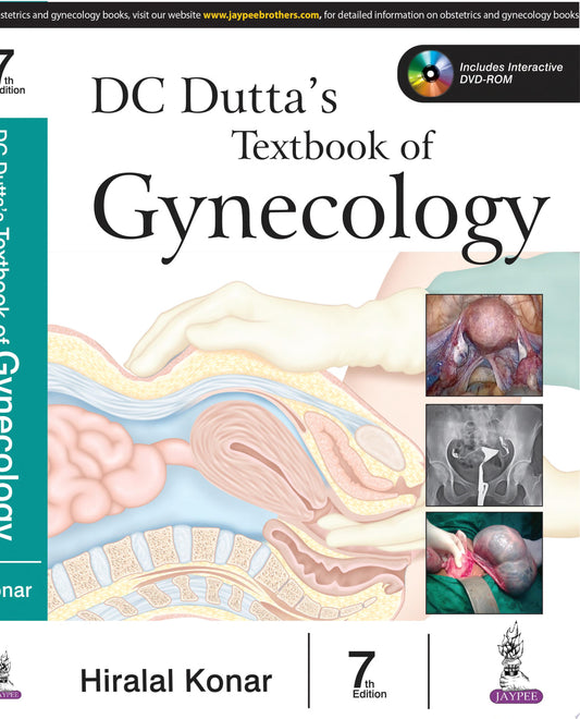 DC Dutta’s Clinics in Gynecology