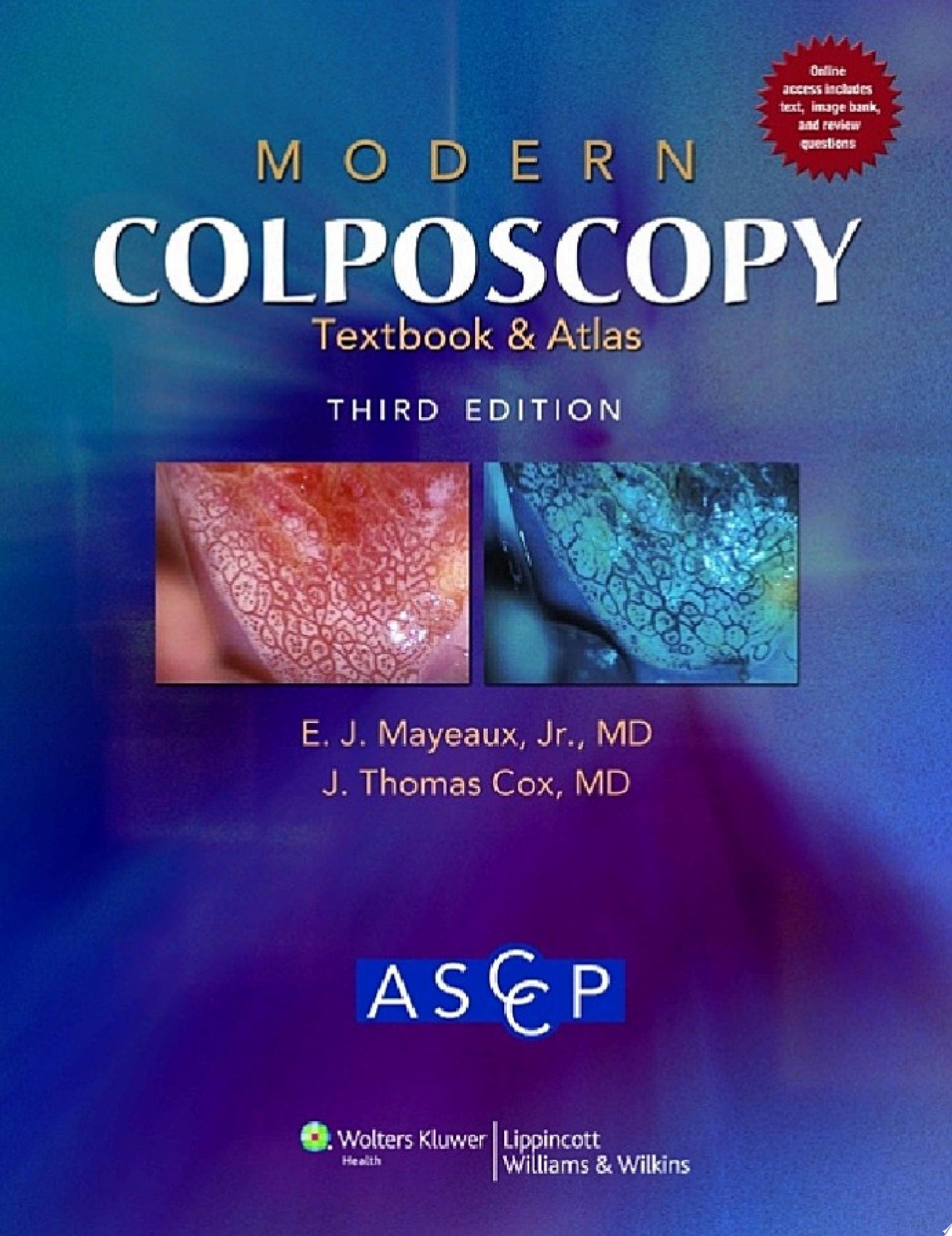 Modern Colposcopy Textbook and Atlas, 3rd Edition