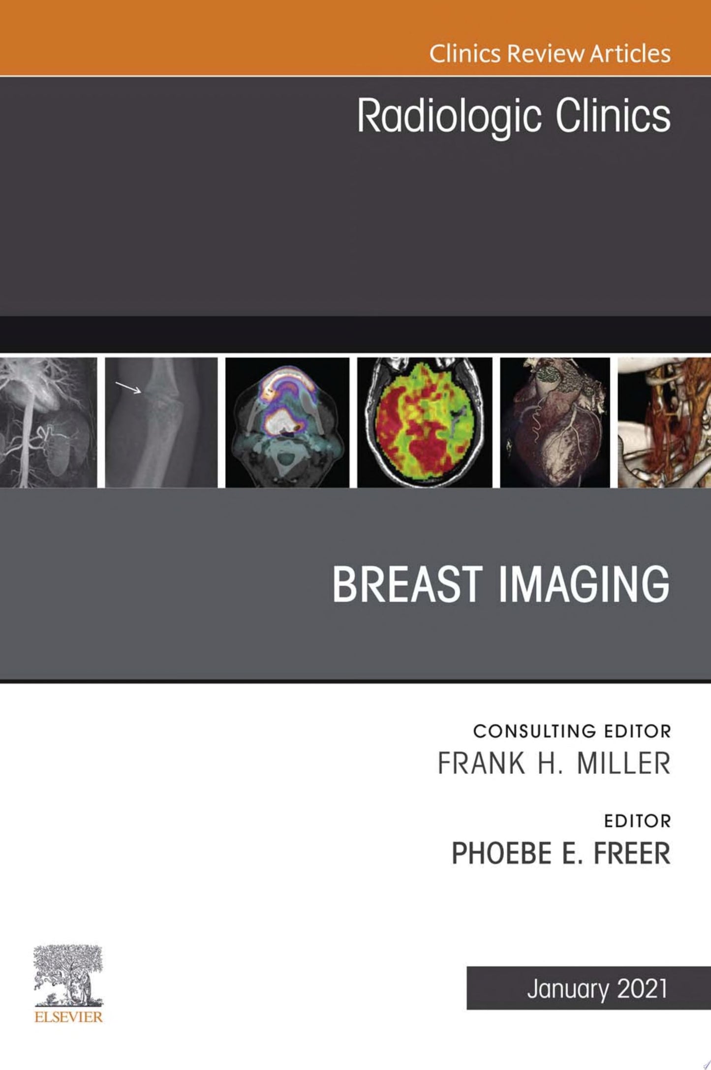 Breast Imaging, An Issue of Radiologic Clinics of North America, 1e