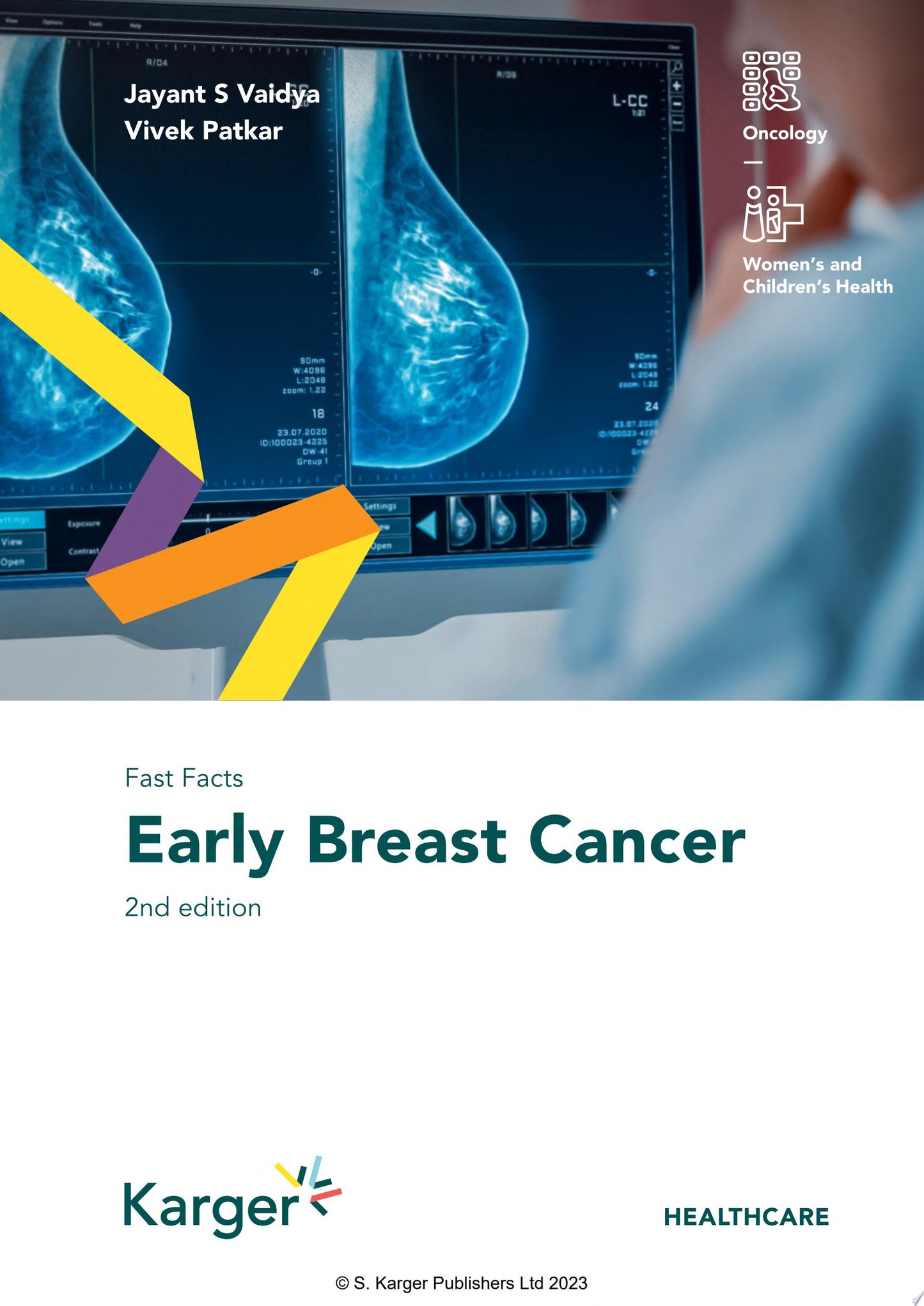Fast Facts: Early Breast Cancer, 2nd Edition