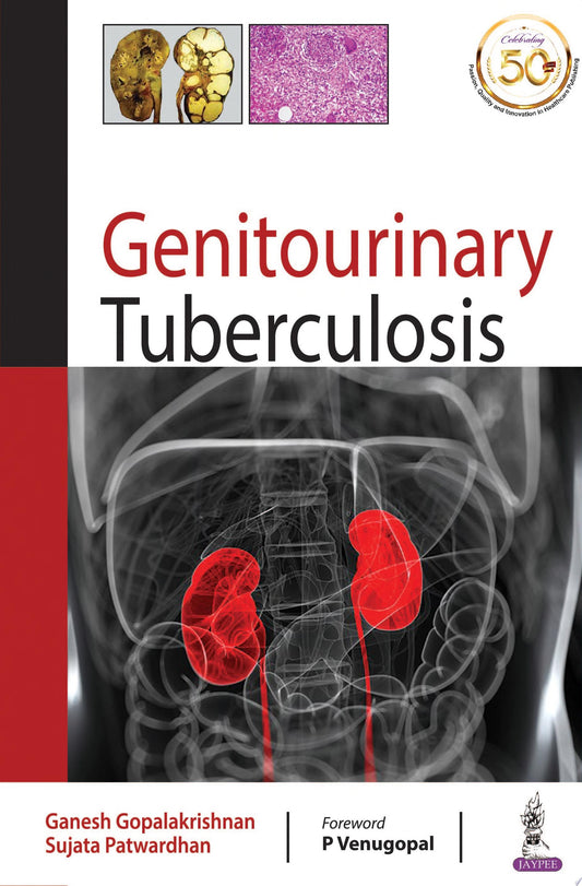 Genitourinary Tuberculosis