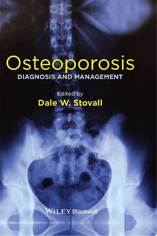 Osteoporosis: Diagnosis and Management